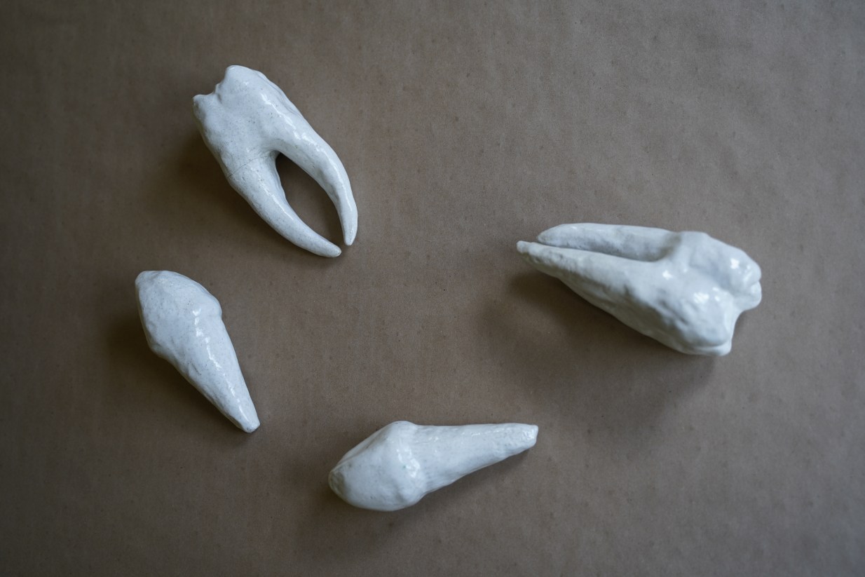 Ceramic Teeth